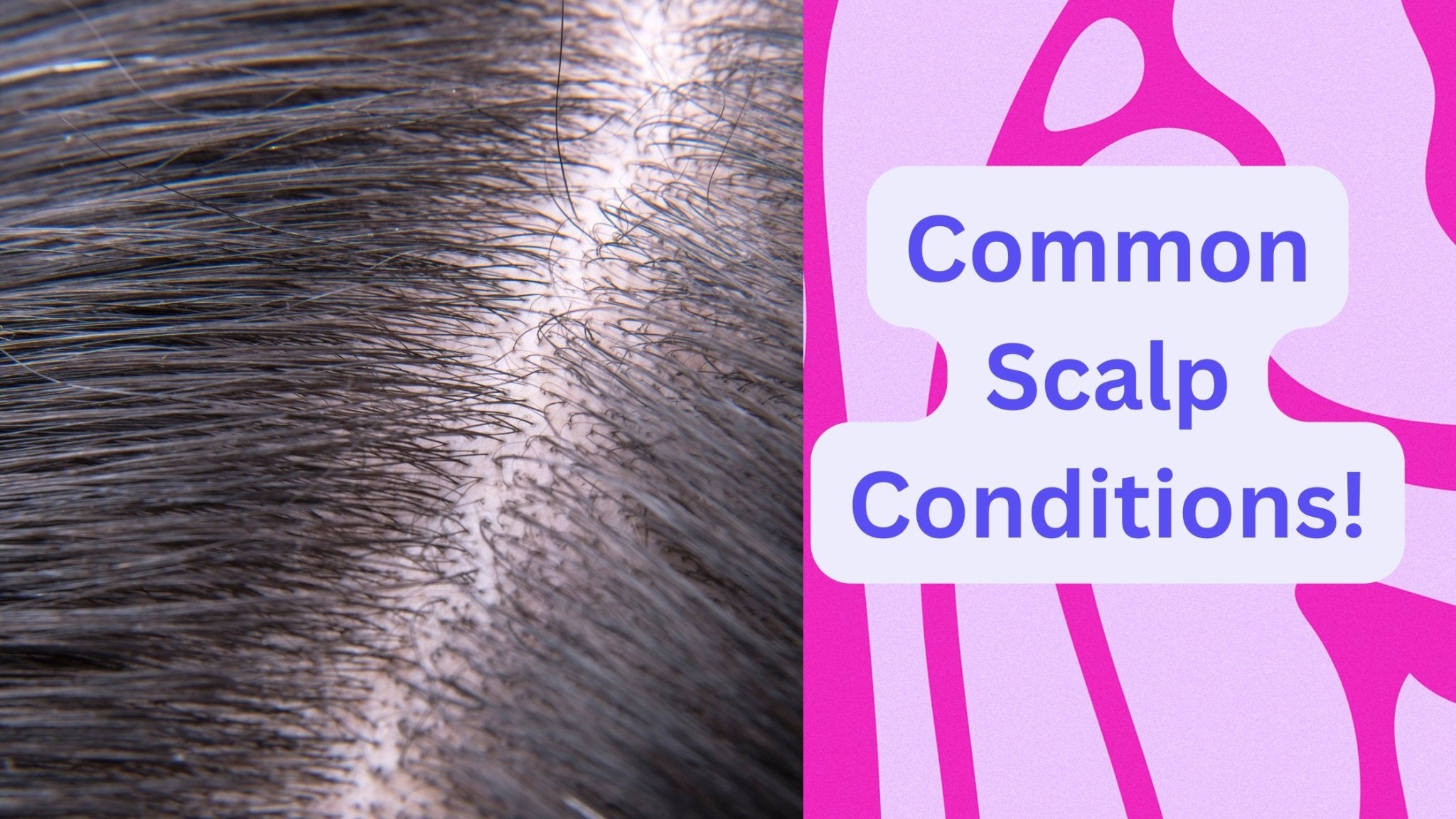 Hair Condition Types What Are The Different Scalp Types And How To Treat These – UBMU