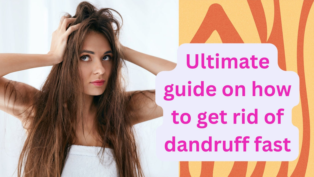 Ultimate guide on how to get rid of dandruff fast - HairNimation